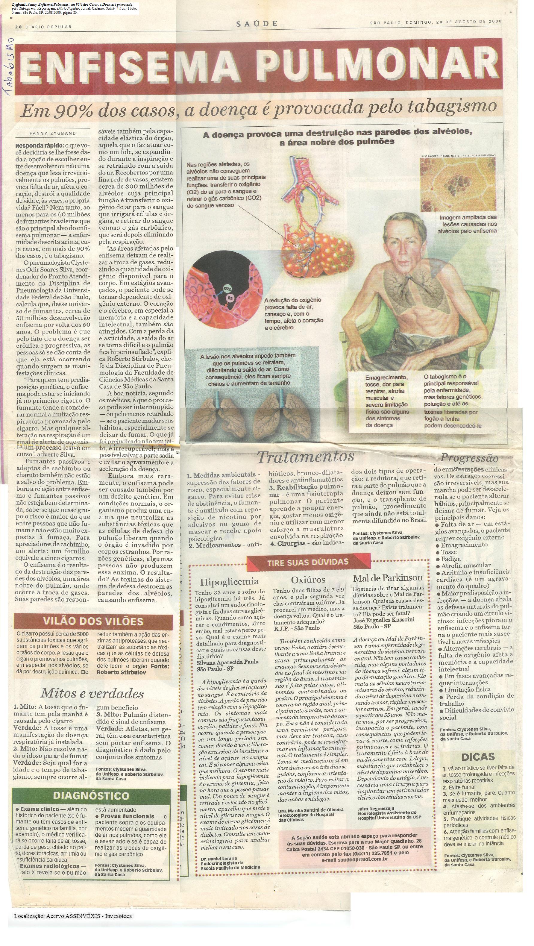 Zygband Fanny Enfisema.jpg